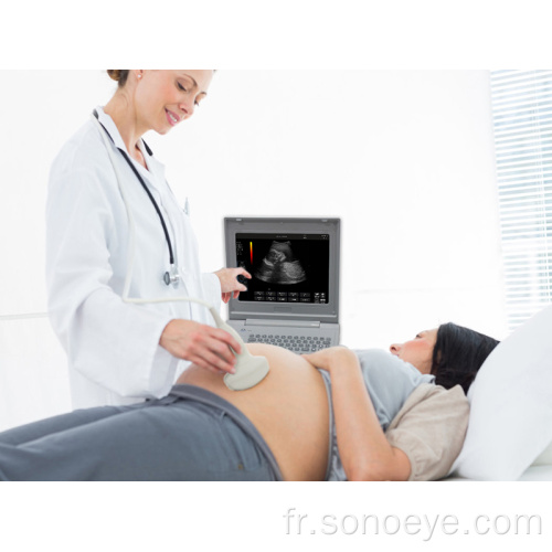 Machine à ultrasons pour ordinateur portable de bonne qualité